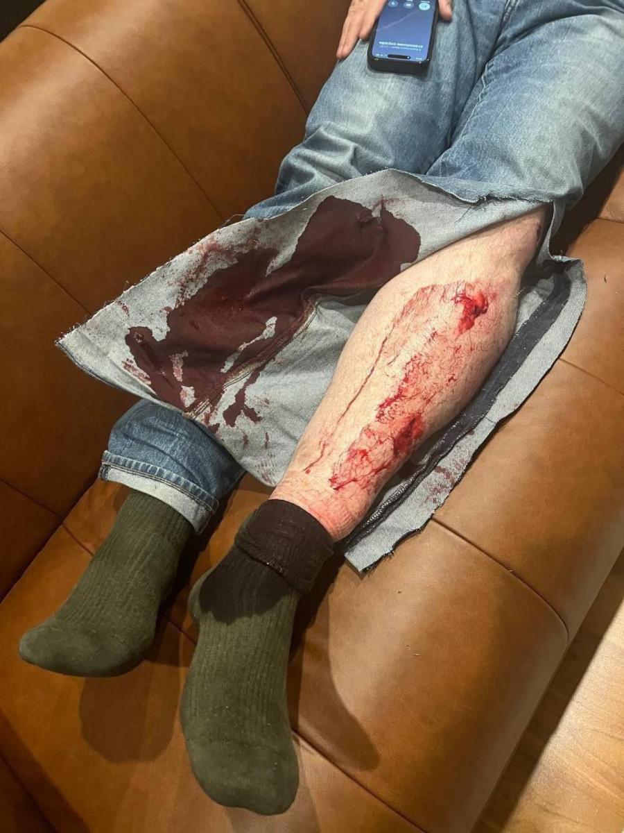 Господин Волков был окровавлен с ног до головы. Господин Волков был окровавлен с ног до головы.
